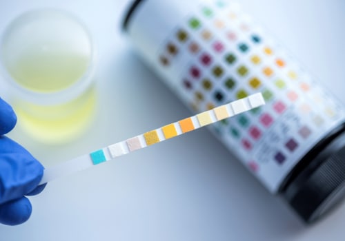 Does delta 10 show up on urine drug tests?